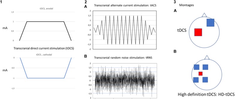 FIGURE 1