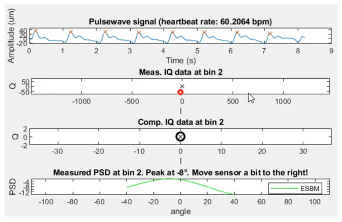 Figure 16