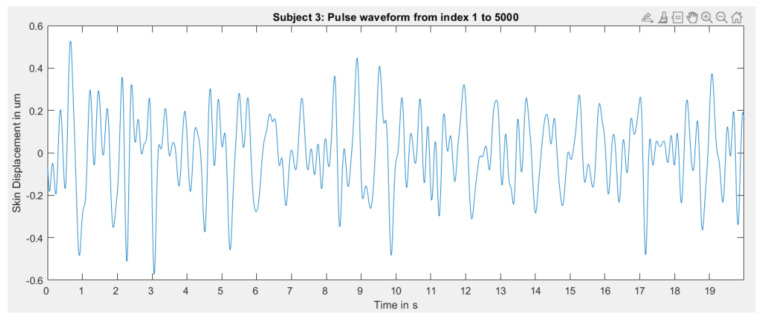 Figure 20