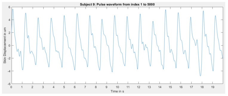 Figure 19