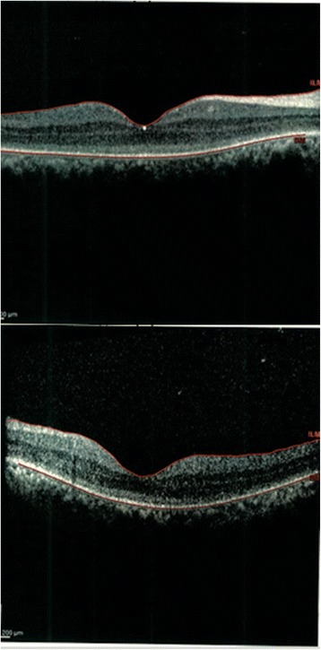 Fig. 4