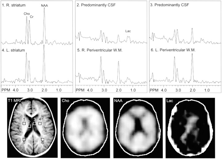 Fig 3.