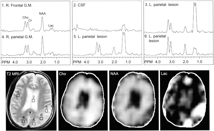 Fig 1.