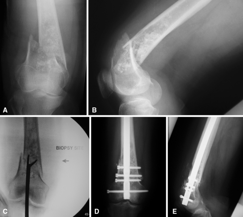 Fig. 1A–E