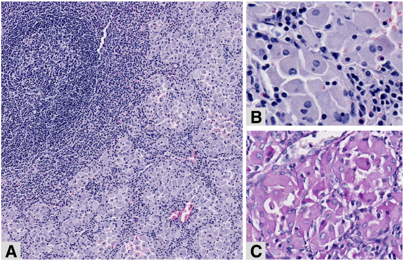 Fig. 1