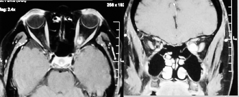 Fig. 22