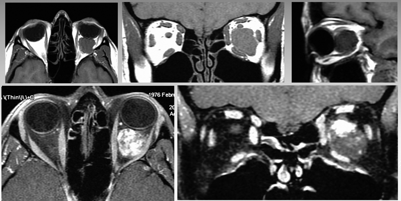 Fig. 18