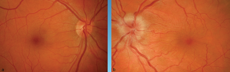 Fig. 13