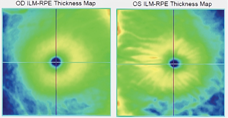 Fig. 17