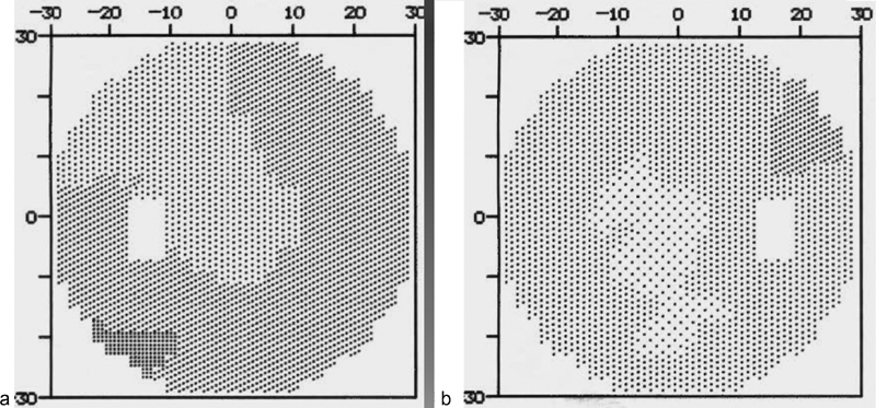 Fig. 12