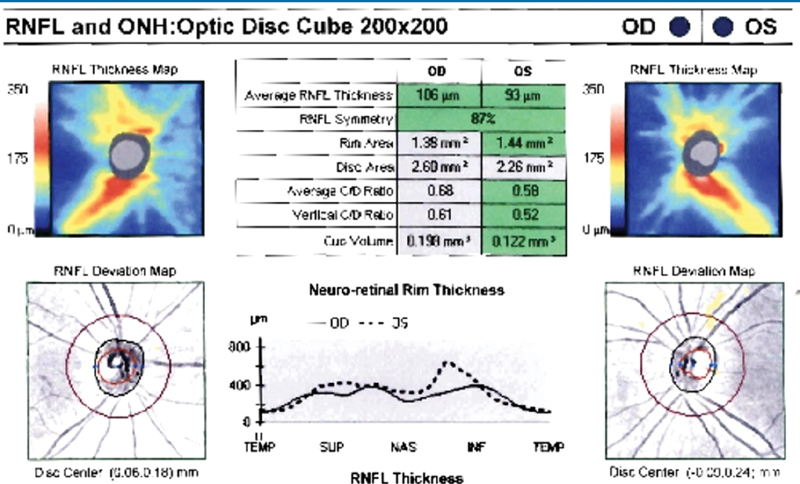 Fig. 21