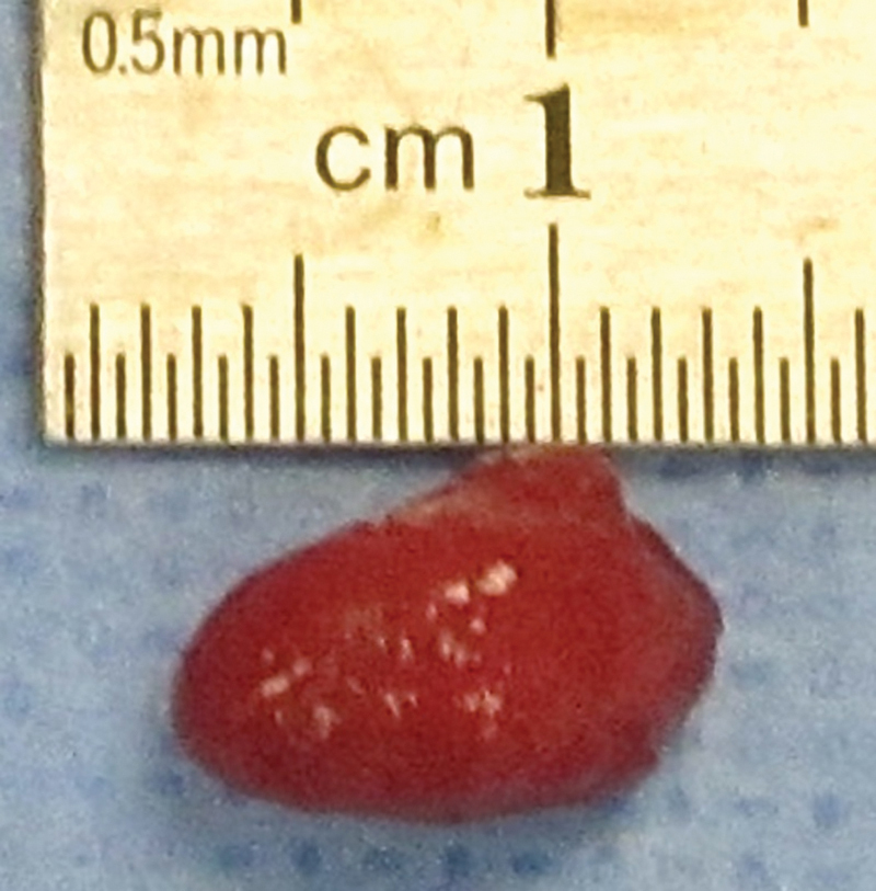 Fig. 23