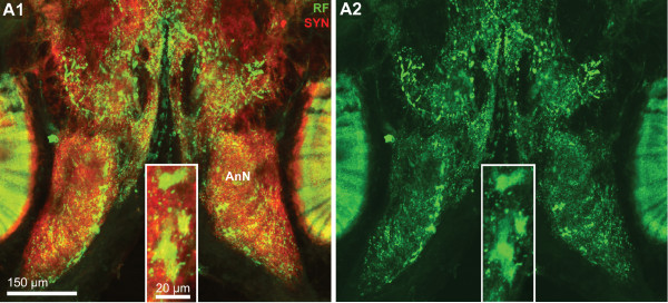 Figure 14