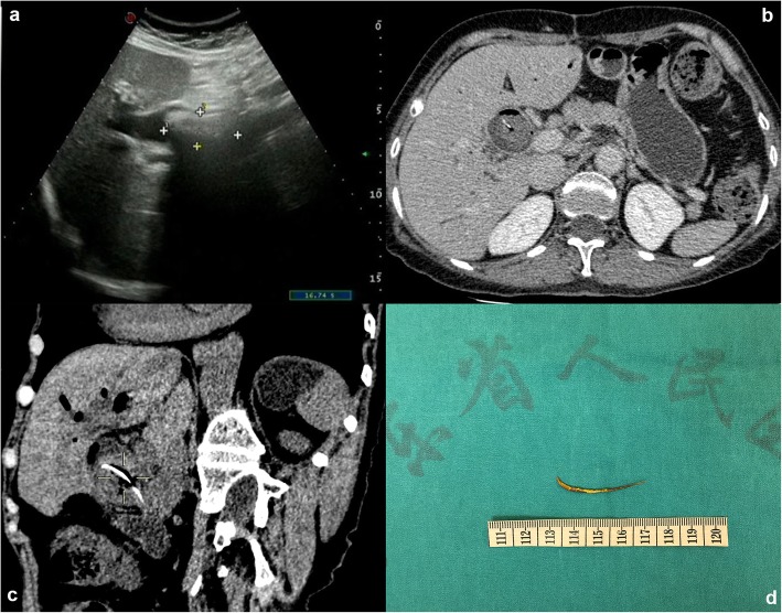 Fig. 1