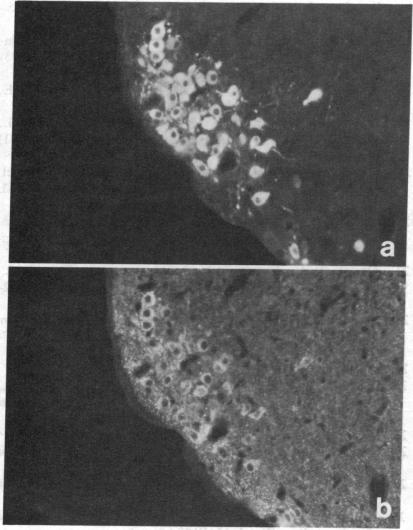 graphic file with name pnas00624-0388-a.jpg