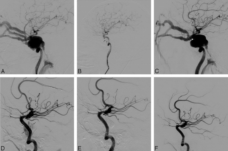 Fig 2.