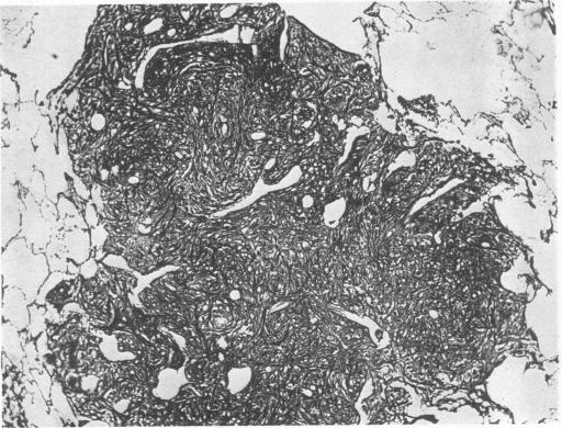 graphic file with name brjindmed00242-0016-b.jpg