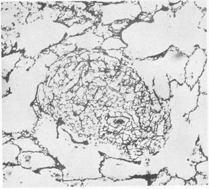 graphic file with name brjindmed00242-0014-a.jpg