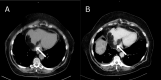 Fig 2:
