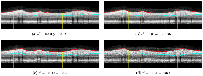 Figure 18