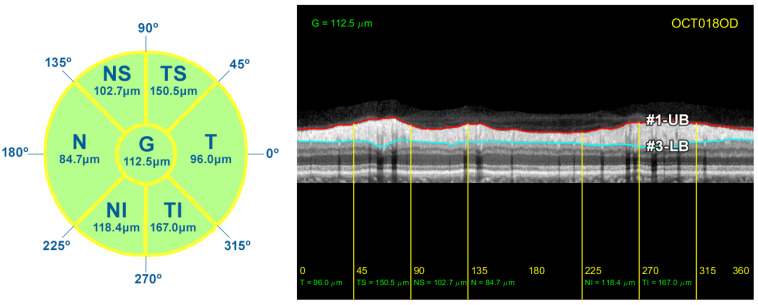 Figure 14