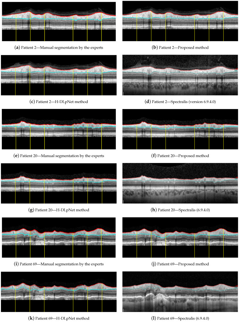 Figure 15