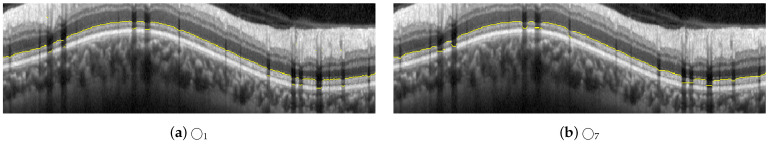 Figure 17