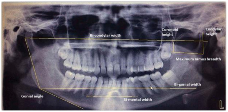 Figure 5