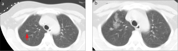 Figure 2 a, b