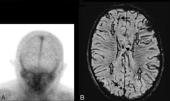 Fig 10.