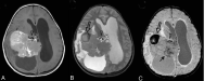 Fig 12.