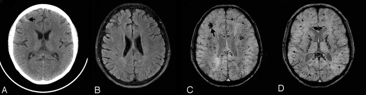 Fig 3.