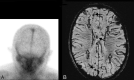 Fig 10.