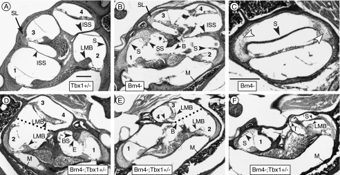 FIG. 1