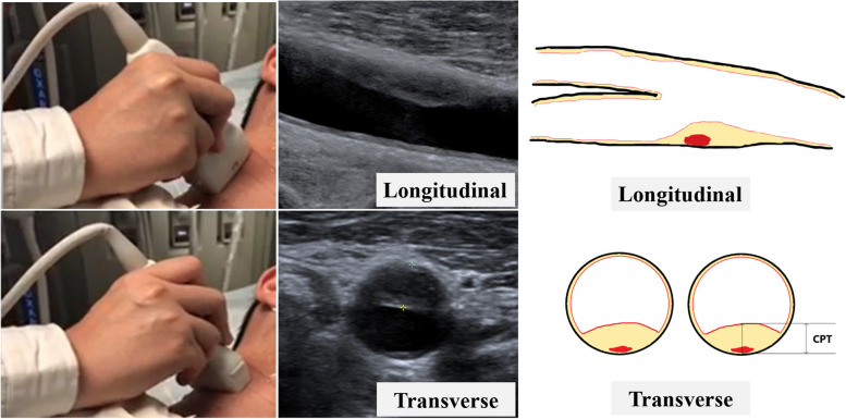 Fig. 2