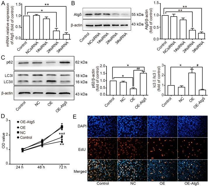 Beclin1 overexpression suppresses tumor cell proliferation and survival ...