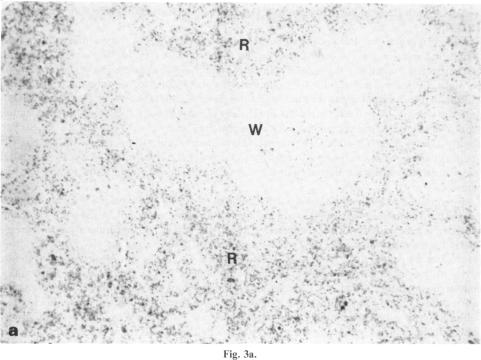 Fig. 3a