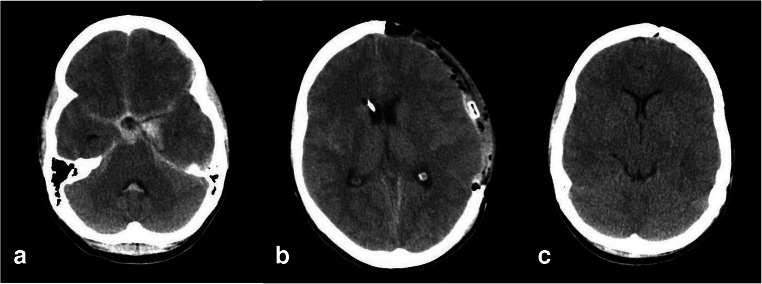 Fig. 2