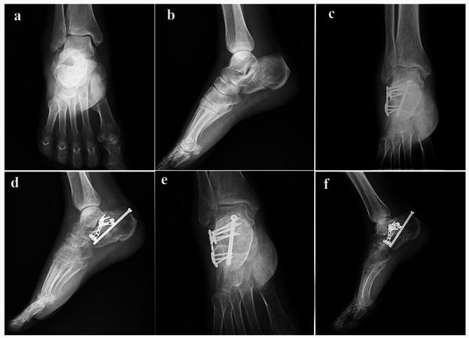 Fig. 4