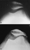 Fig. 3A–B