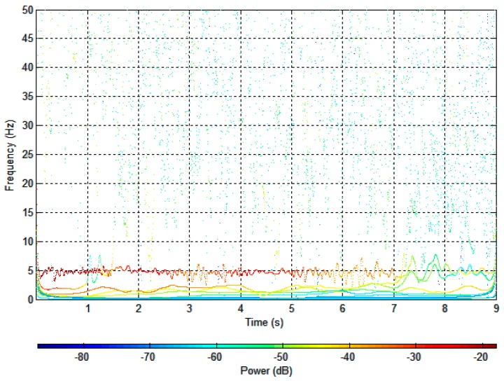 Figure 11