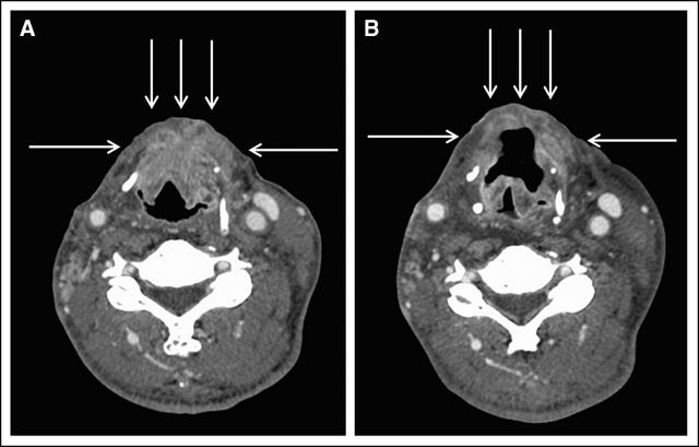 Fig 1.