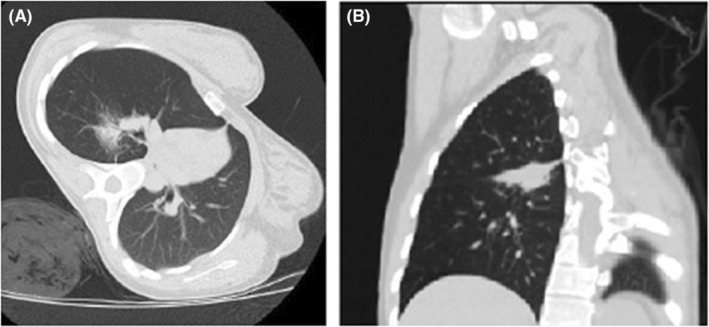 FIGURE 1