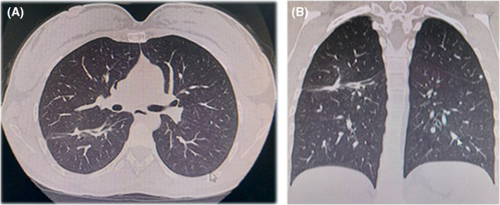 FIGURE 3