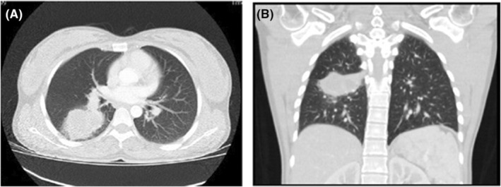 FIGURE 2