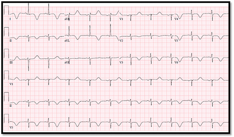 Fig 4