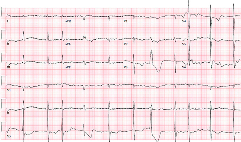 Fig 5