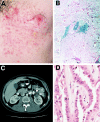 Figure  1