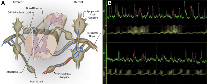 Figure 1