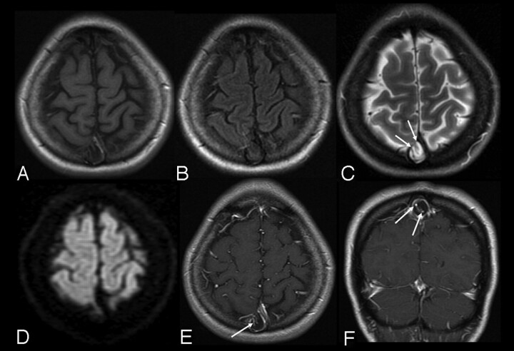 Fig 2.